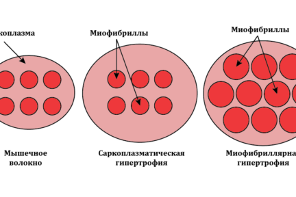 Миниатюра для записи Виды гипертрофии мышц